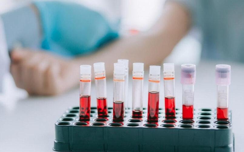 Врачи смогут оценивать риск развития болезни Крона по анализу крови